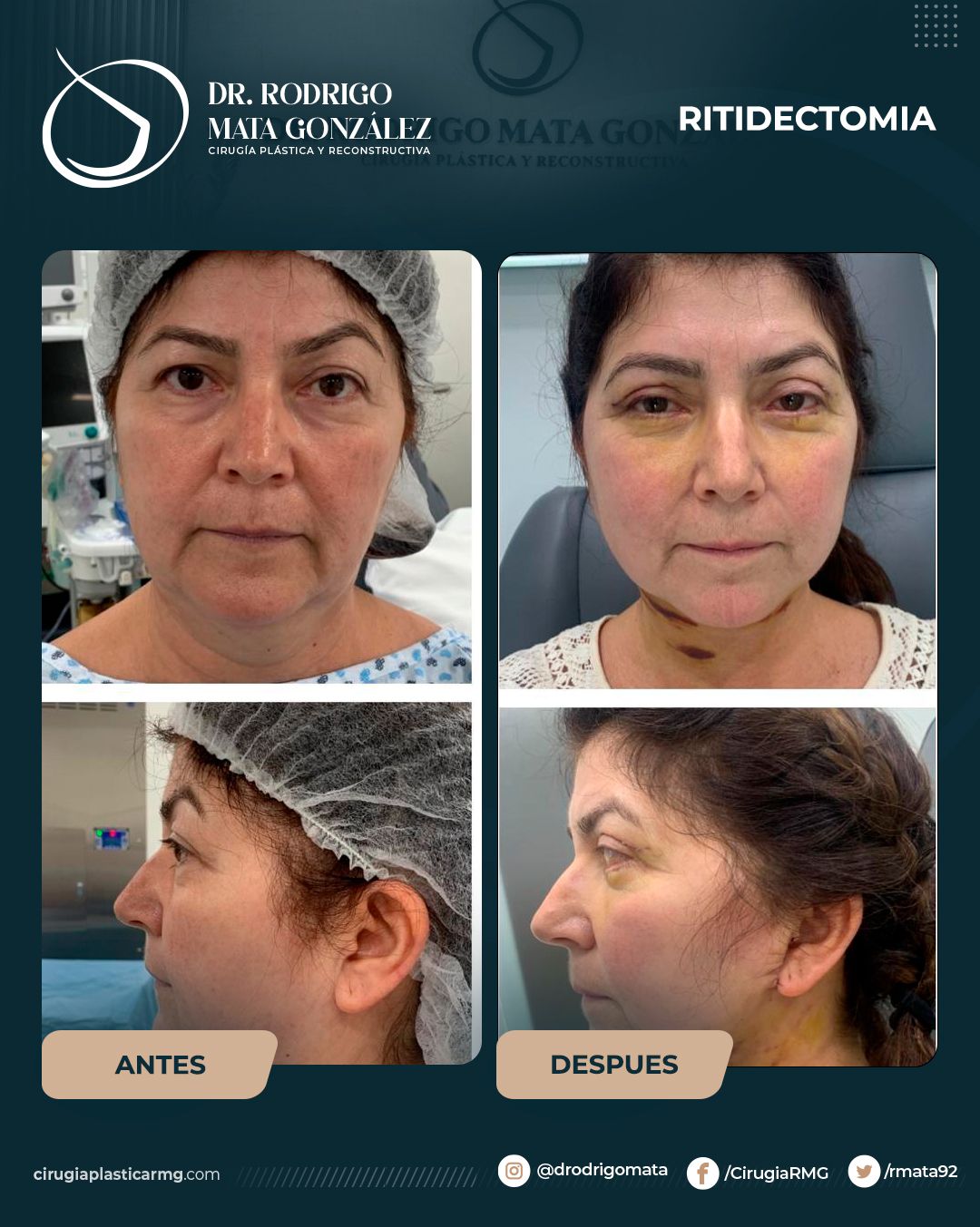 Rodrigo Mata Gonzalez-11