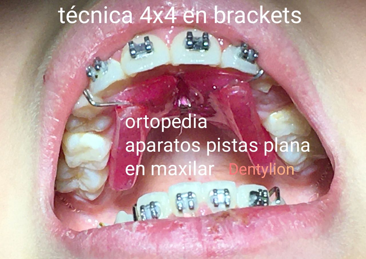 Jessica De La Barrera Valladolid-25