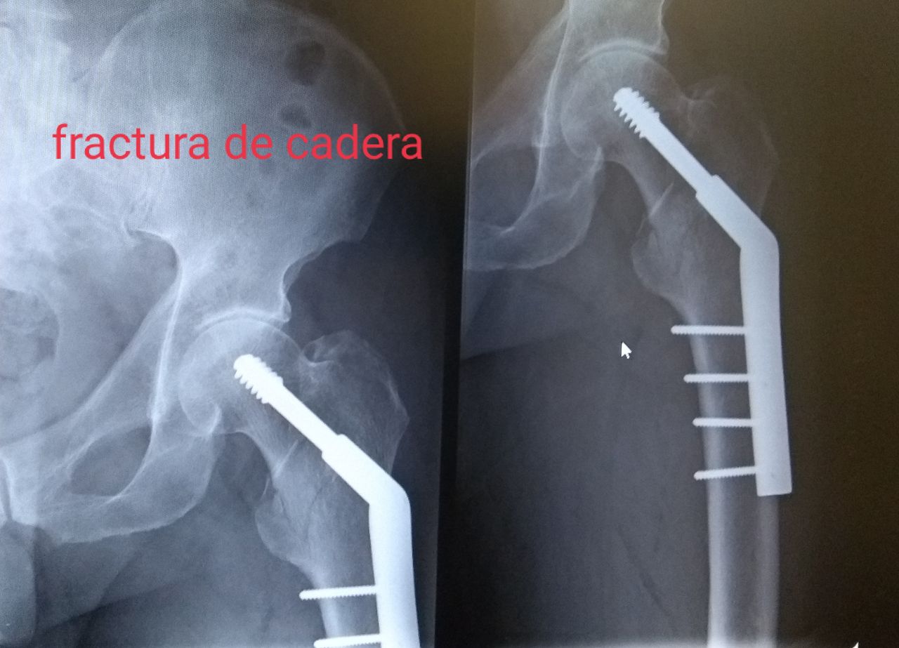Jorge Aragon Aguilar-9