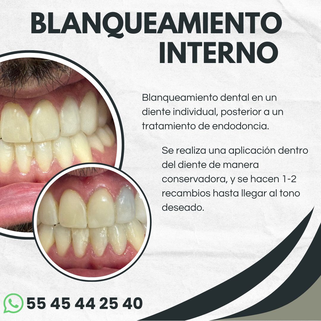 Karla Garnica Elguero-9