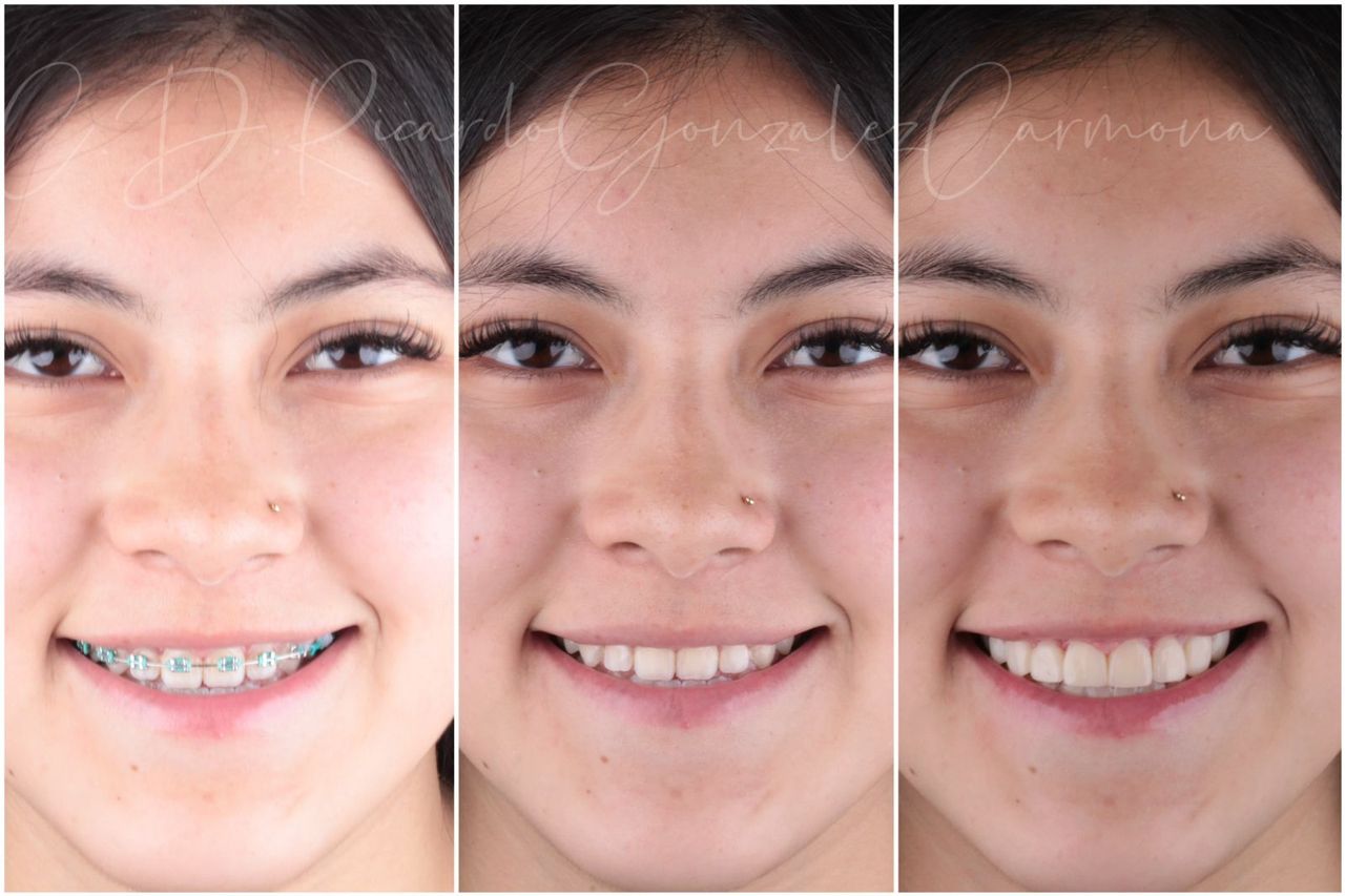 Alicia Carmona López-16