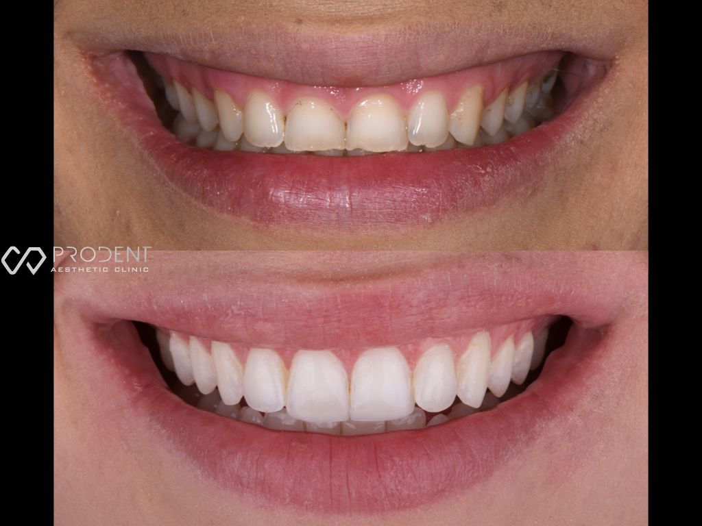 Ulises Pérez Murillo-72