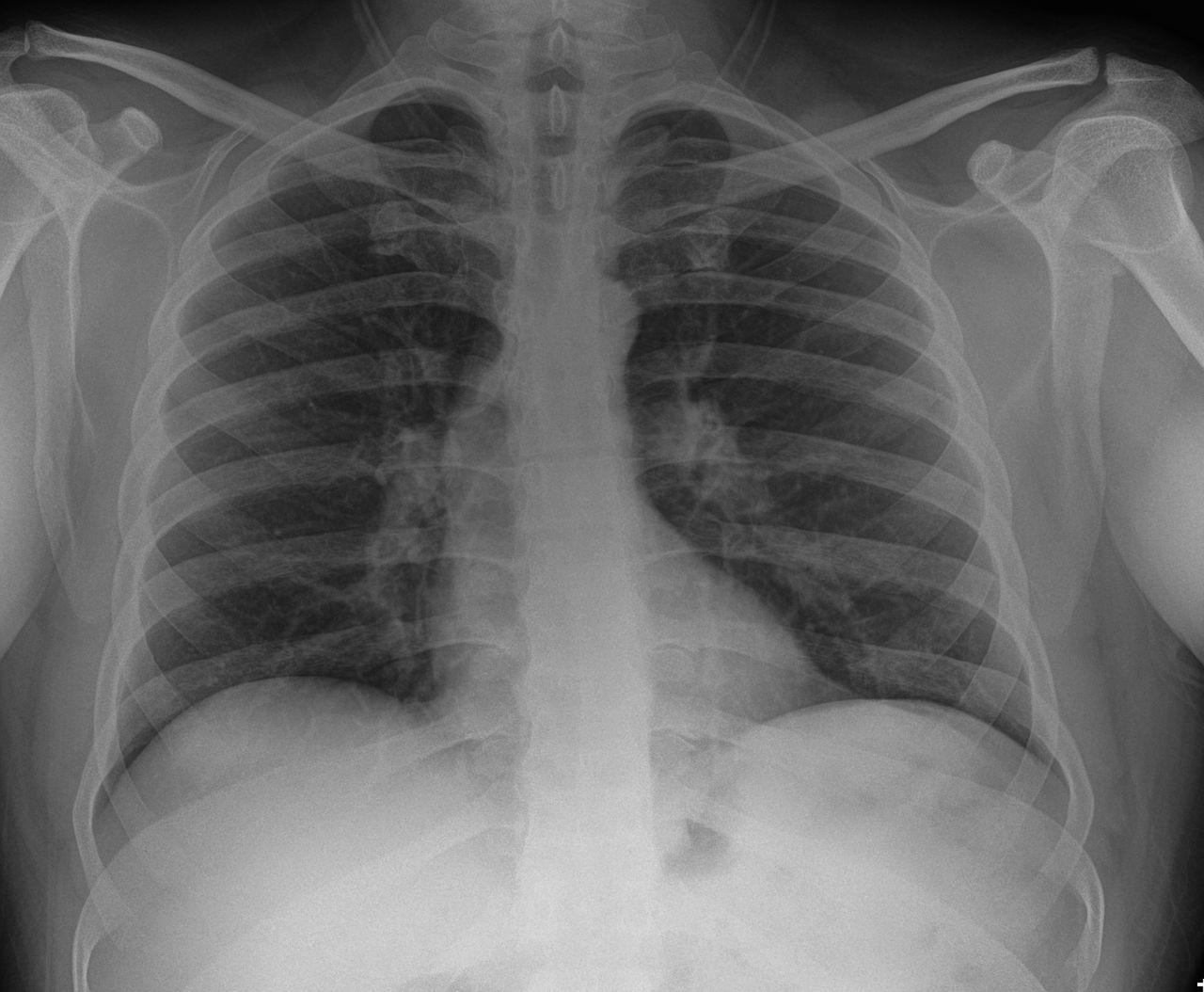 Samuel Garza Pacheco -3