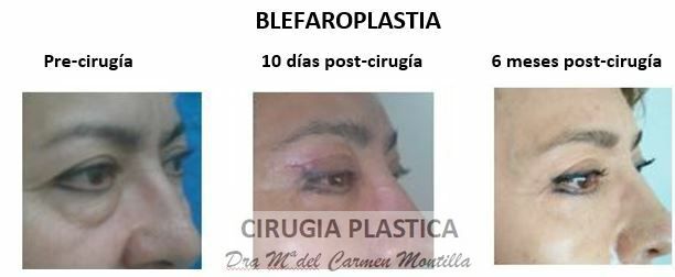 María Del Carmen Montilla Muñoz-0