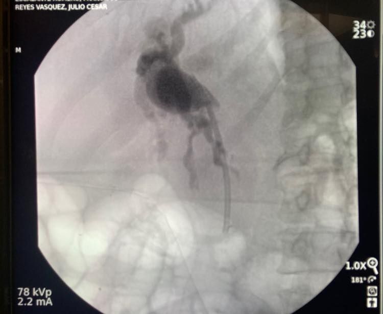 J. César Reyes Vásquez-19