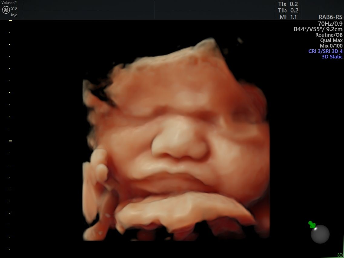 Arturo Herrera Flores-4