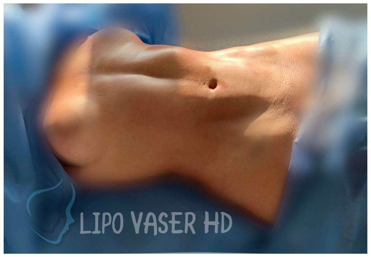 Giuseppe Tanzillo-26