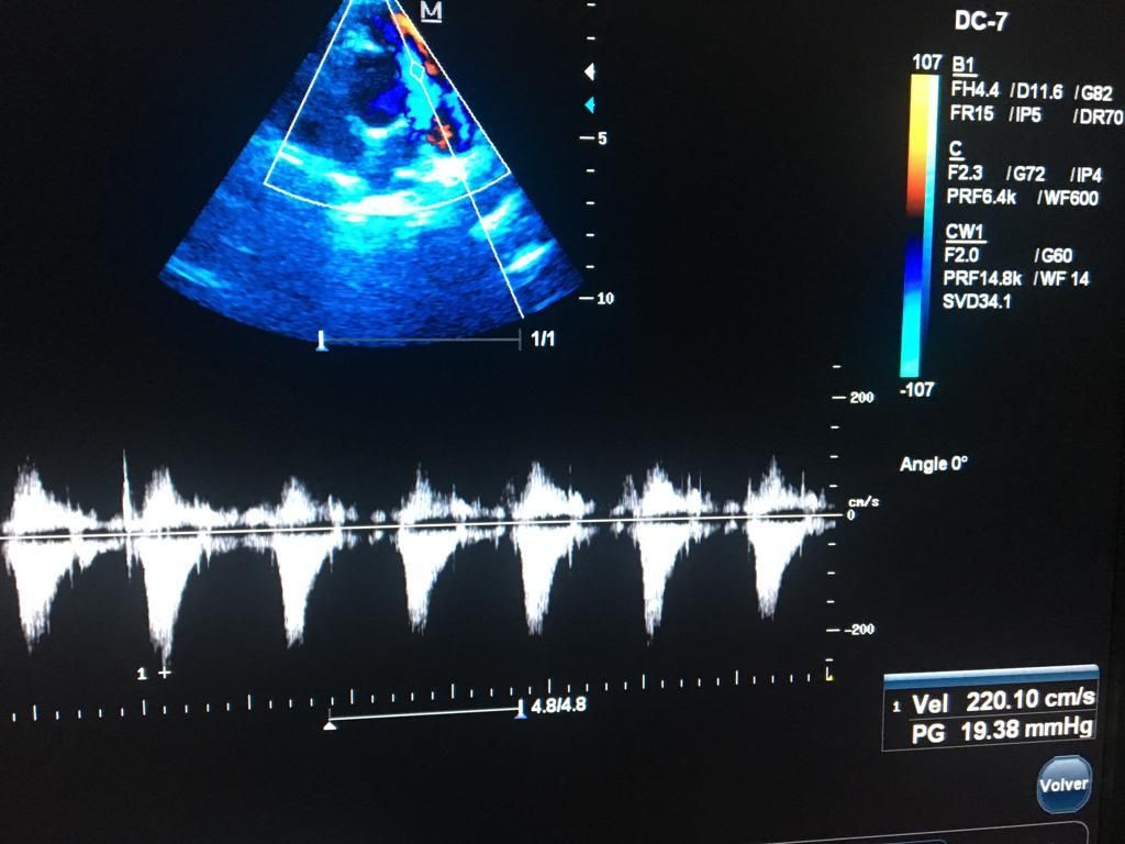 Christian Nava Bello-13