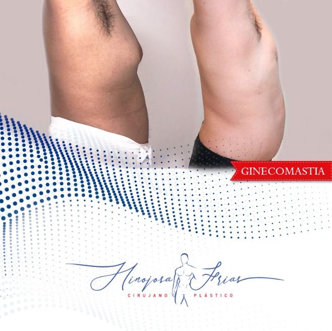 Miguel Ángel Hinojosa Frías-15