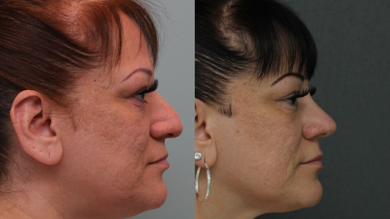 Angel Castro Urquizo-39