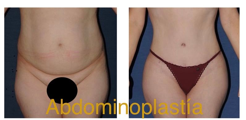 Ubaldo Carpinteyro Espín-12