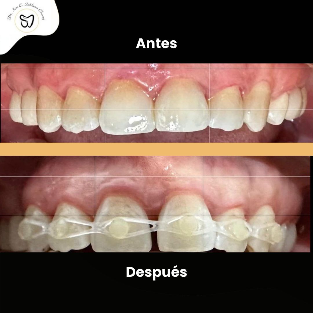 Ian Carlo Saldaña Chong-1