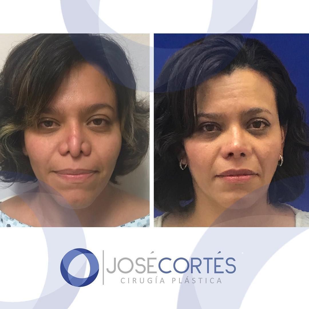 José Cortés Arreguin-17