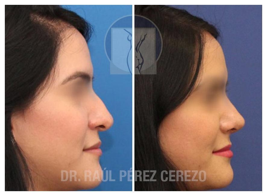 Raúl Pérez Cerezo-14