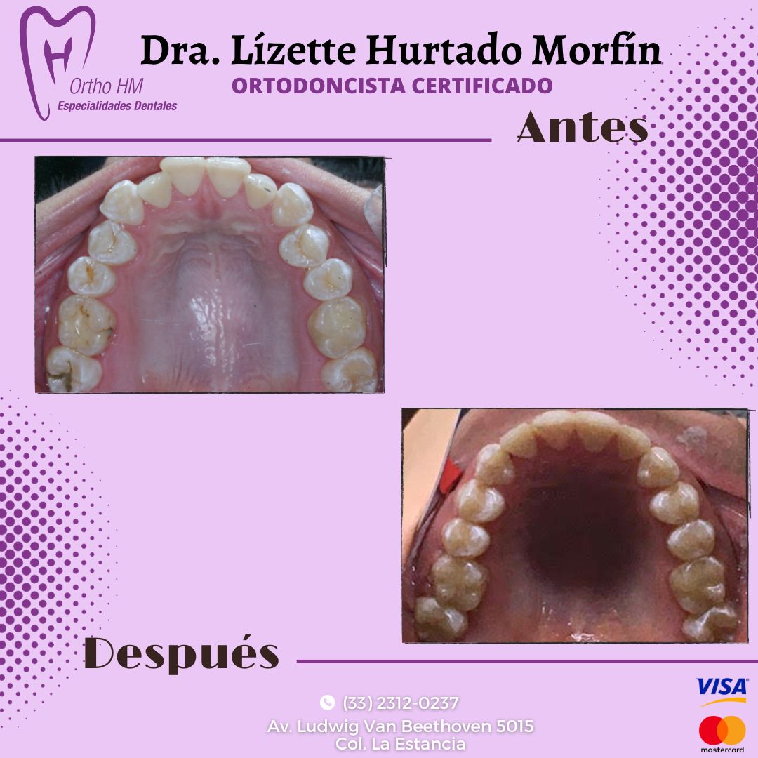 Lizette S. Hurtado Morfin-2