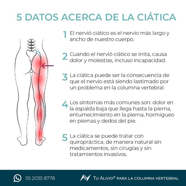 Ampliar imagen: 