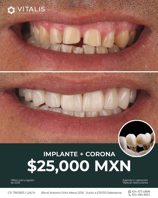 Ampliar imagen: 